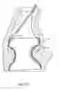 Fig. 40 - Method of treating a patient using a retrievable transcatheter prosthetic heart valve