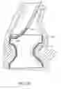 Fig. 41 - Method of treating a patient using a retrievable transcatheter prosthetic heart valve