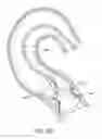 Fig. 43 - Method of treating a patient using a retrievable transcatheter prosthetic heart valve
