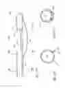 Fig. 81 - Method of treating a patient using a retrievable transcatheter prosthetic heart valve