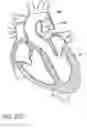 Fig. 92 - Method of treating a patient using a retrievable transcatheter prosthetic heart valve