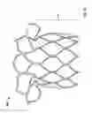 Fig. 07 - Stents with anchoring sections