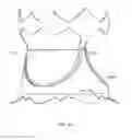 Fig. 07 - Collapsible prosthetic heart valves
