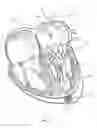 Fig. 06 - Methods for delivery of prosthetic mitral valves
