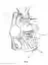 Fig. 07 - Methods for delivery of prosthetic mitral valves