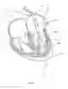 Fig. 08 - Methods for delivery of prosthetic mitral valves