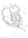 Fig. 10 - Methods for delivery of prosthetic mitral valves