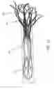Fig. 24 - Methods for delivery of prosthetic mitral valves