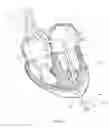 Fig. 44 - Methods for delivery of prosthetic mitral valves