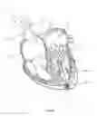 Fig. 46 - Methods for delivery of prosthetic mitral valves
