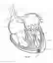 Fig. 47 - Methods for delivery of prosthetic mitral valves