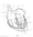 Fig. 49 - Methods for delivery of prosthetic mitral valves