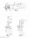 Fig. 05 - Inversion delivery device and method for a prosthesis