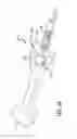 Fig. 12 - Inversion delivery device and method for a prosthesis
