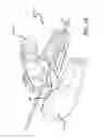 Fig. 14 - Inversion delivery device and method for a prosthesis