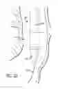 Fig. 17 - Inversion delivery device and method for a prosthesis