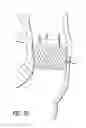 Fig. 23 - Inversion delivery device and method for a prosthesis