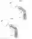 Fig. 11 - Hip joint device