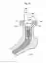 Fig. 16 - Hip joint device