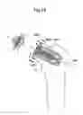 Fig. 20 - Hip joint device