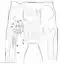 Fig. 01 - VARIABLE PROSTHESIS