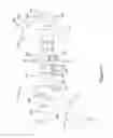 Fig. 07 - VARIABLE PROSTHESIS