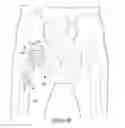 Fig. 13 - VARIABLE PROSTHESIS
