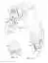 Fig. 09 - Prosthetic having a modular soft tissue fixation mechanism