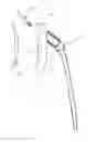 Fig. 01 - Methods, Devices and Techniques for Improved Placement and Fixation of Shoulder Implant Components