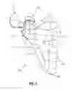 Fig. 05 - Methods, Devices and Techniques for Improved Placement and Fixation of Shoulder Implant Components