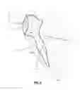 Fig. 06 - Methods, Devices and Techniques for Improved Placement and Fixation of Shoulder Implant Components