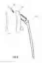 Fig. 09 - Methods, Devices and Techniques for Improved Placement and Fixation of Shoulder Implant Components