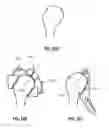 Fig. 16 - Methods, Devices and Techniques for Improved Placement and Fixation of Shoulder Implant Components