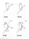 Fig. 20 - Methods, Devices and Techniques for Improved Placement and Fixation of Shoulder Implant Components
