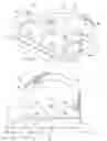 Fig. 03 - Artificial spinal disk prosthesis