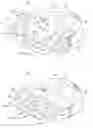 Fig. 05 - Artificial spinal disk prosthesis