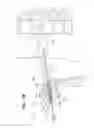Fig. 09 - Implants and guides for inserting an implant