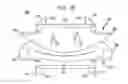 Fig. 07 - Instruments and methods for inserting artificial intervertebral implants