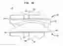 Fig. 08 - Instruments and methods for inserting artificial intervertebral implants