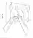 Fig. 35 - Instruments and methods for inserting artificial intervertebral implants