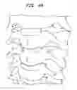 Fig. 43 - Instruments and methods for inserting artificial intervertebral implants