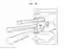Fig. 45 - Instruments and methods for inserting artificial intervertebral implants