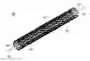 Fig. 01 - STENT
