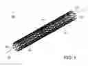 Fig. 02 - STENT
