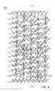Fig. 05 - STENT