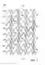 Fig. 08 - STENT