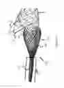 Fig. 05 - Implant retention, detachment, and delivery system