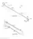 Fig. 07 - URETERAL ENDOLUMINAL DEVICE