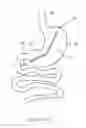 Fig. 06 - Bougie including a light source for performing gastroplasty