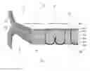 Fig. 05 - AUTOGRAFT REINFORCEMENT OF STAPLED TISSUE